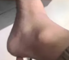 ГЕЛЬ ДЛЯ СУГЛОБІВ ВІД ПОДАГРИ